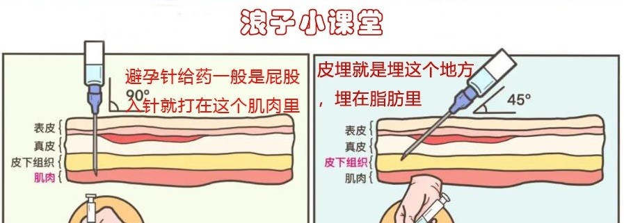 体内给药途径.jpg